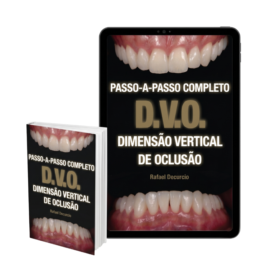 Ebook DVO - Passo a Passo Completo